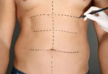 عمل زیبایی بدن