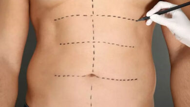 عمل زیبایی بدن