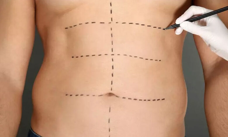 عمل زیبایی بدن