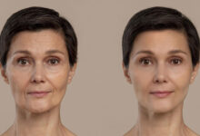 عمل زیبایی صورت