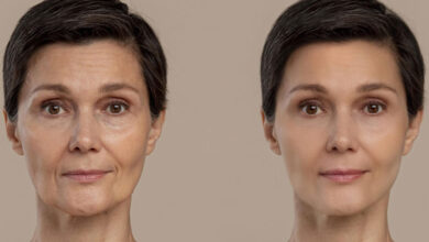 عمل زیبایی صورت