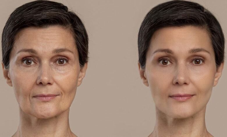 عمل زیبایی صورت