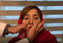 آموزش ماساژ بینی بعد از عمل