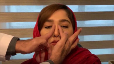 آموزش ماساژ بینی بعد از عمل