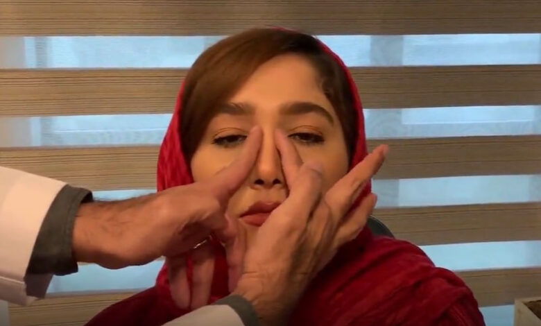 آموزش ماساژ بینی بعد از عمل