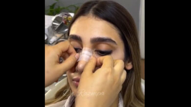 فیلم آموزشی نحوه صحیح چسب زدن بینی توسط پزشک